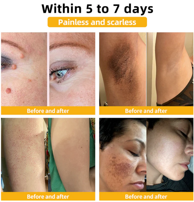 ✨Bee Venom Treatment Cream | 🎁 Paga 1 - Lleva 2 😍