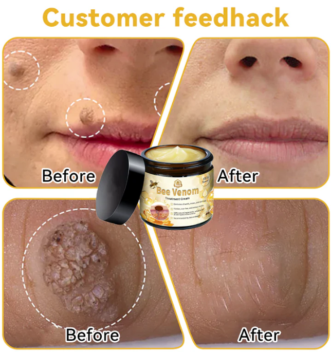 ✨Bee Venom Treatment Cream | 🎁 Paga 1 - Lleva 2 😍